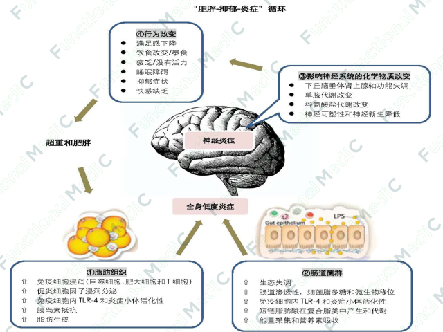 温故而知新专栏 | 抑郁症的抗炎症治疗